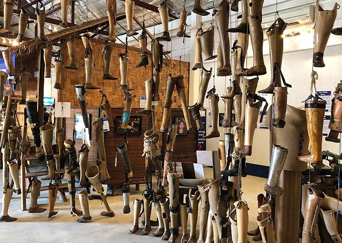 Prosthetic Feet, Cope Visitor Centre